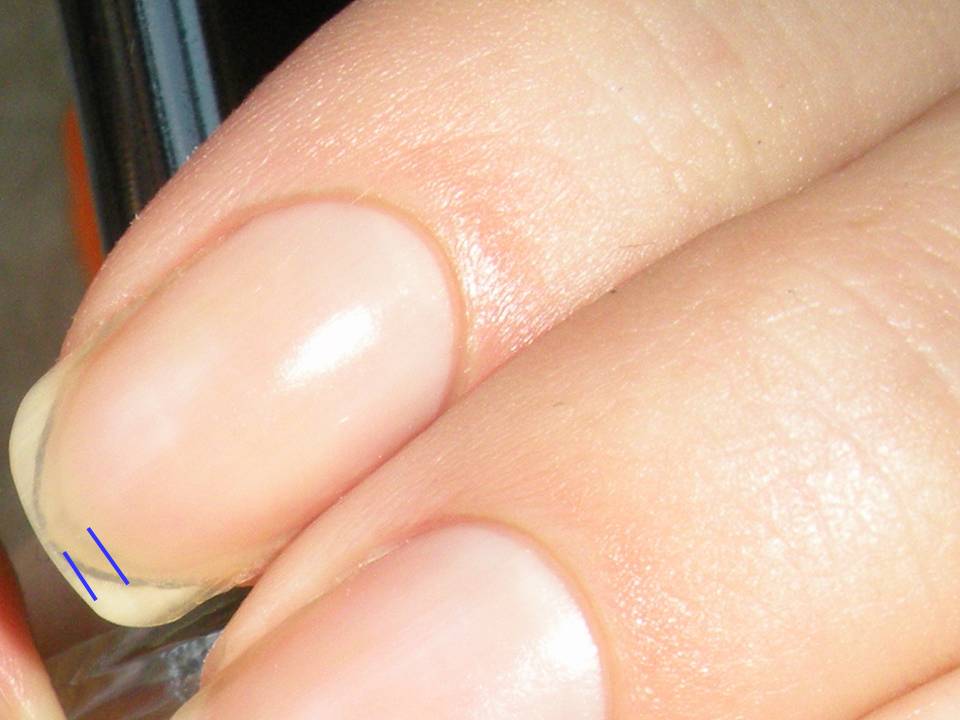 What is the free edge of the nail?